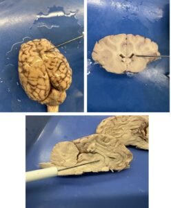 sheep brain anatomy